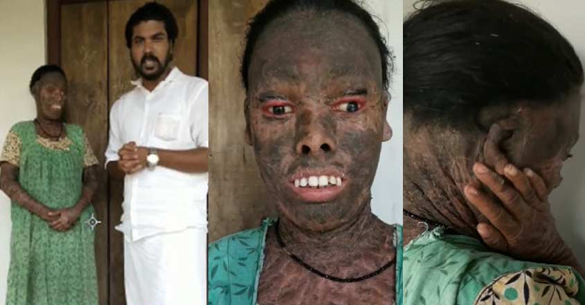 ആരും ജോലി തരുന്നില്ല; മനുഷ്യനായി പോലും കണക്കാക്കുന്നില്ല: കേഴുന്ന മനസ്സുമായി പ്രീതി