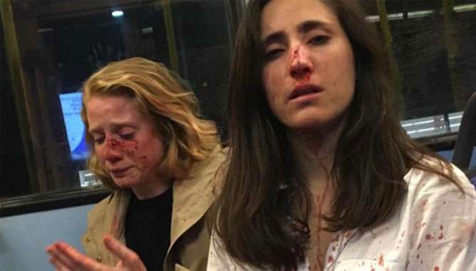 ഉമ്മ വെക്കാന്‍ ആവശ്യപ്പെട്ടു;  നിരസിച്ച  സ്വവര്‍ഗ സ്ത്രീ പങ്കാളികളെ   ബസ് യാത്രക്കാര്‍ക്കിടെ വെച്ച് സംഘം ചേര്‍ന്ന് മര്‍ദിച്ചു