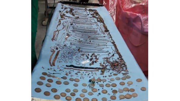 ശസ്ത്രക്രിയക്കിടെ യുവതിയുടെ വയറ്റില്‍ നിന്ന് കണ്ടെത്തിയത്  1.5 കിലോ ആഭരണങ്ങളും 90 നാണയങ്ങളും