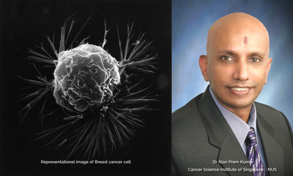 സ്തനാര്‍ബുദ ചികിത്സയ്ക്ക് പ്രത്യാശയായി മലയാളി ശാസ്ത്രഞ്ജന്‍റെ കണ്ടുപിടുത്തം
