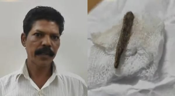 ചേലക്കര താലൂക്ക് ആശുപത്രിയില്‍ ചികിത്സാപ്പിഴവ്; തുന്നിക്കെട്ടിയ മുറിവില്‍ നിന്ന് 5 മാസത്തിന് ശേഷം മരച്ചീള് കണ്ടെത്തി