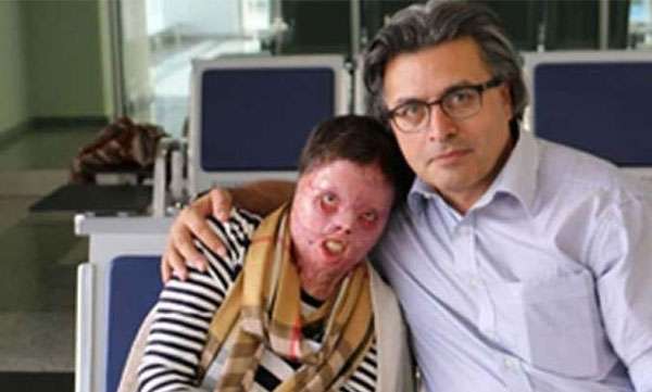 ഐ എസ് കാട്ടാളന്മാരുടെ പിടിയില്‍ നിന്നും മാനം രക്ഷിക്കാന്‍ സ്വന്തം ശരീരം കത്തിച്ചു വികൃതമാക്കിയ പെണ്‍കുട്ടി