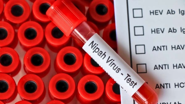 പാലക്കാട് നിപ ബാധ: സമ്പര്‍ക്കപ്പട്ടികയില്‍ 112 പേർ; സംസ്ഥാനത്ത് ആകെ 609 പേര്‍