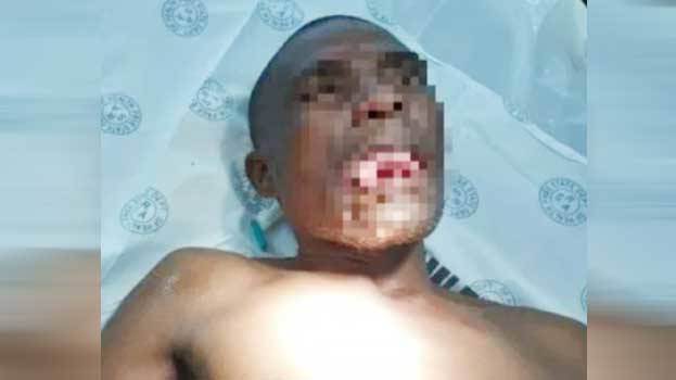 പീഡിപ്പിക്കാൻ ശ്രമിച്ചവന്റെ നാവ് വനിതാ ഡോക്ടർ കടിച്ചെടുത്തു